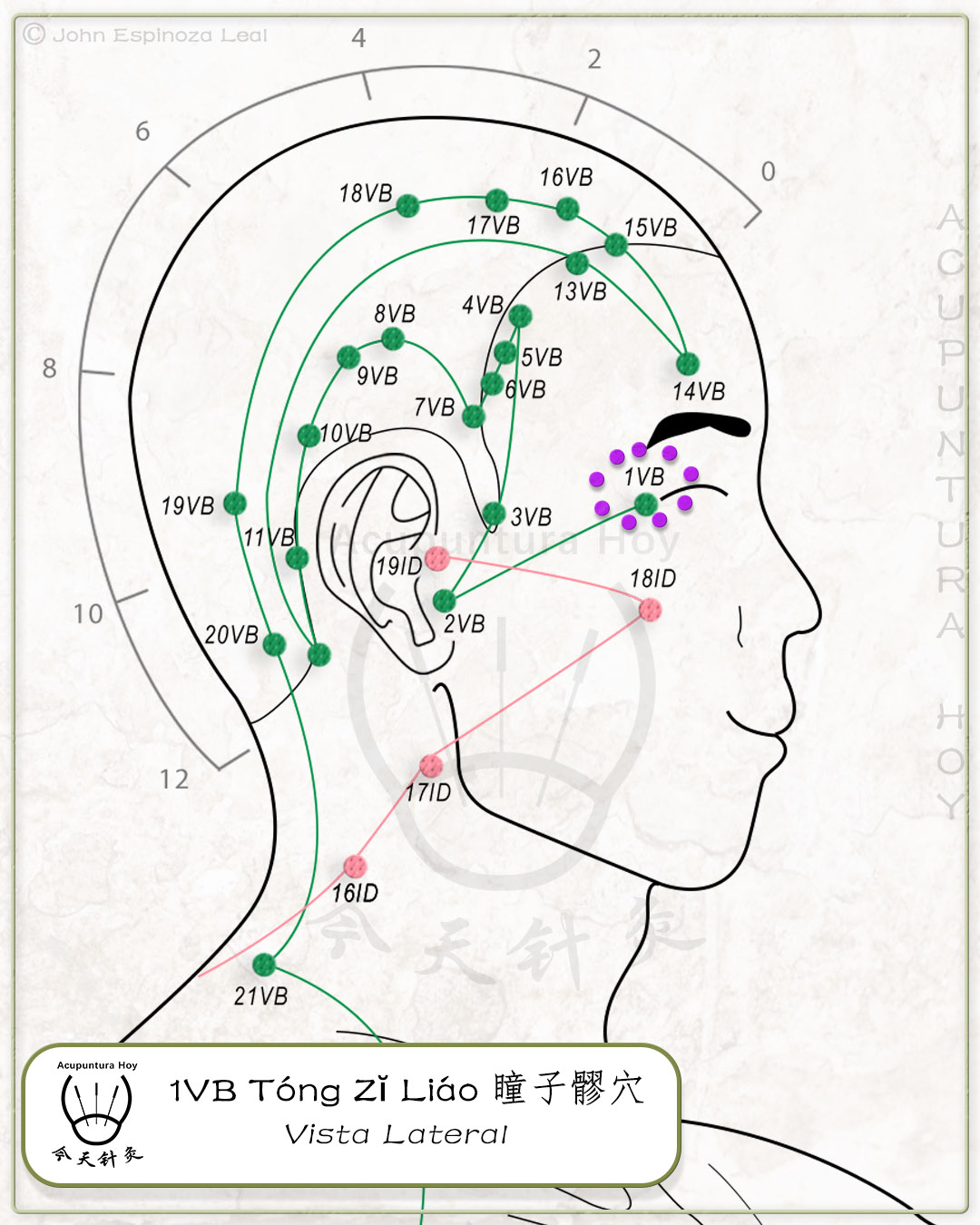 1VB Tóng Zĭ Liáo 瞳子髎穴