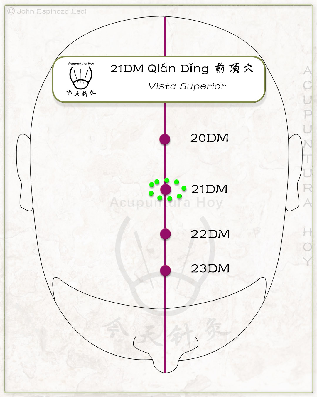 21DM Qián Dĭng 前顶穴