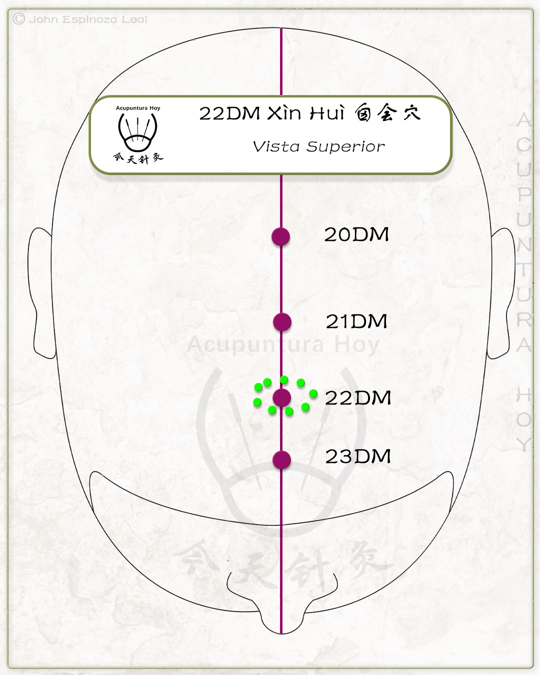 22DM Xìn Huì 囟会穴