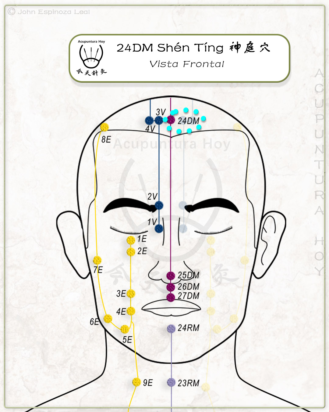 24DM Shén Tíng 神庭穴