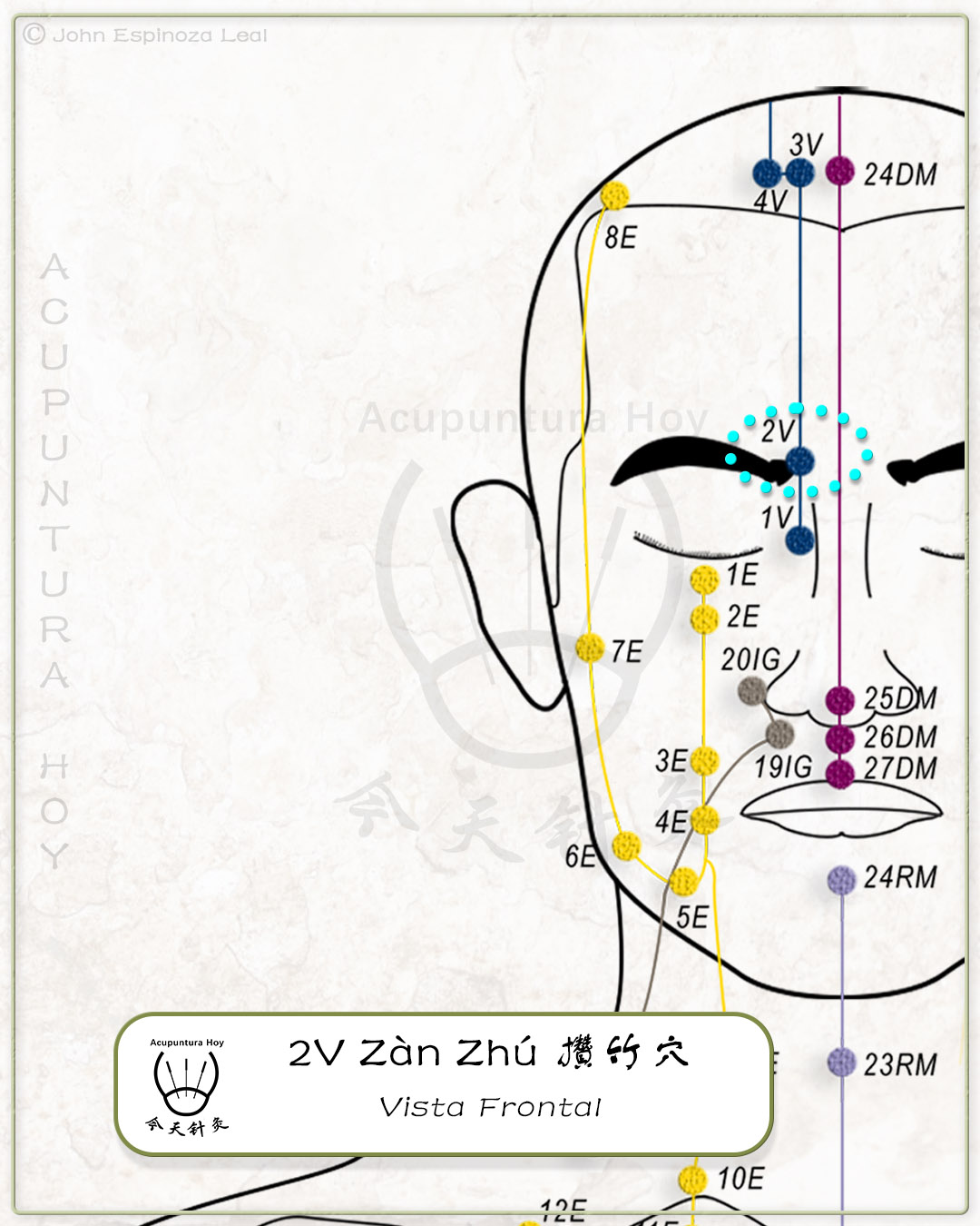 2V Zàn Zhú 攢竹穴