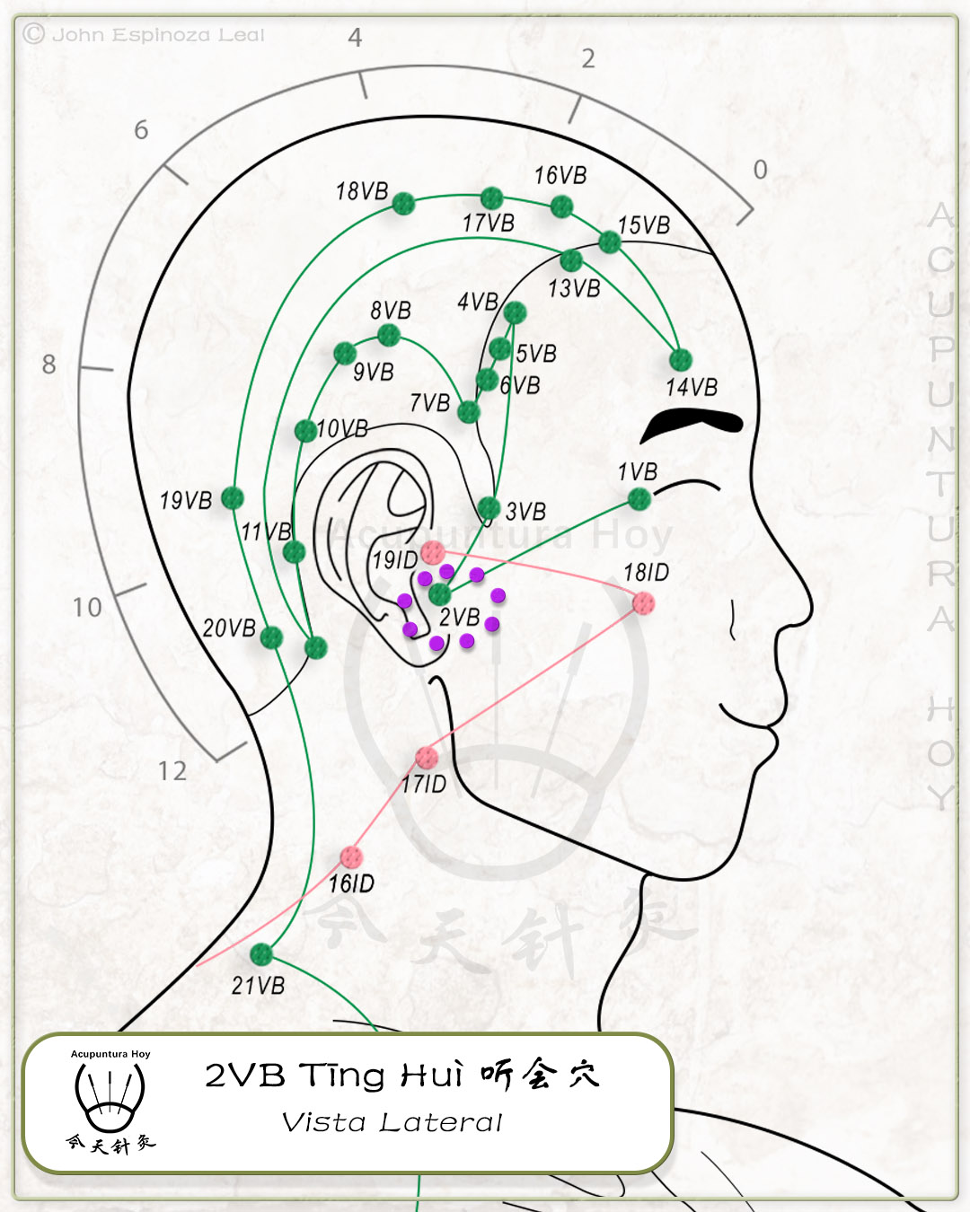 2VB Tīng Huì 听会穴