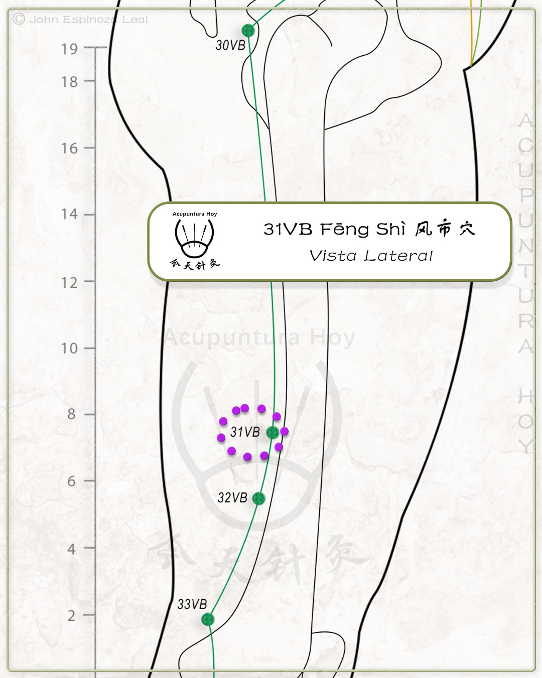 31VB Fēng Shì 风市穴