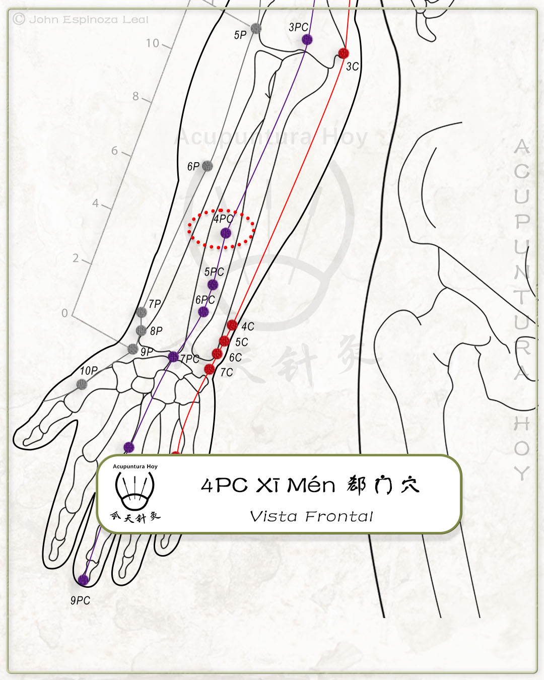 4PC Xī Mén 郄门穴