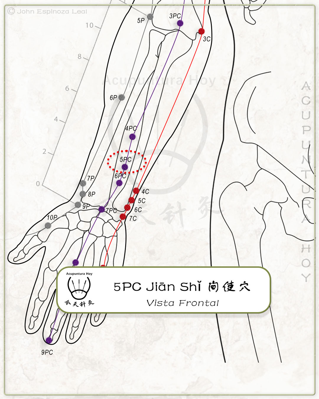 5PC Jiān Shĭ 间使穴
