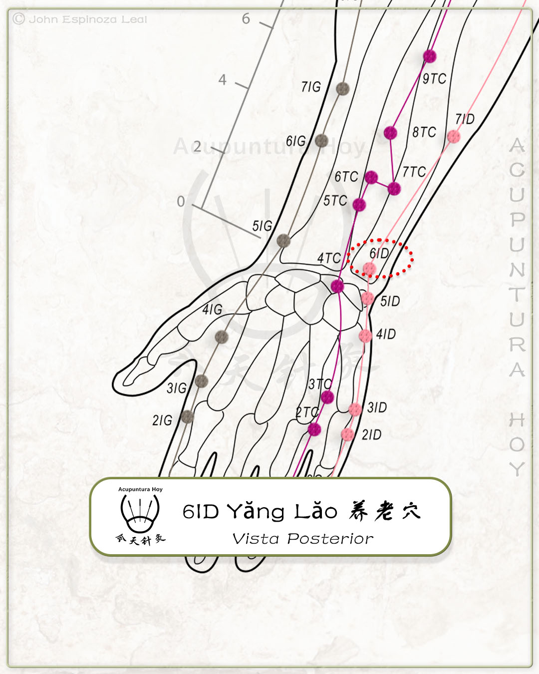 6ID Yăng Lăo 养老穴