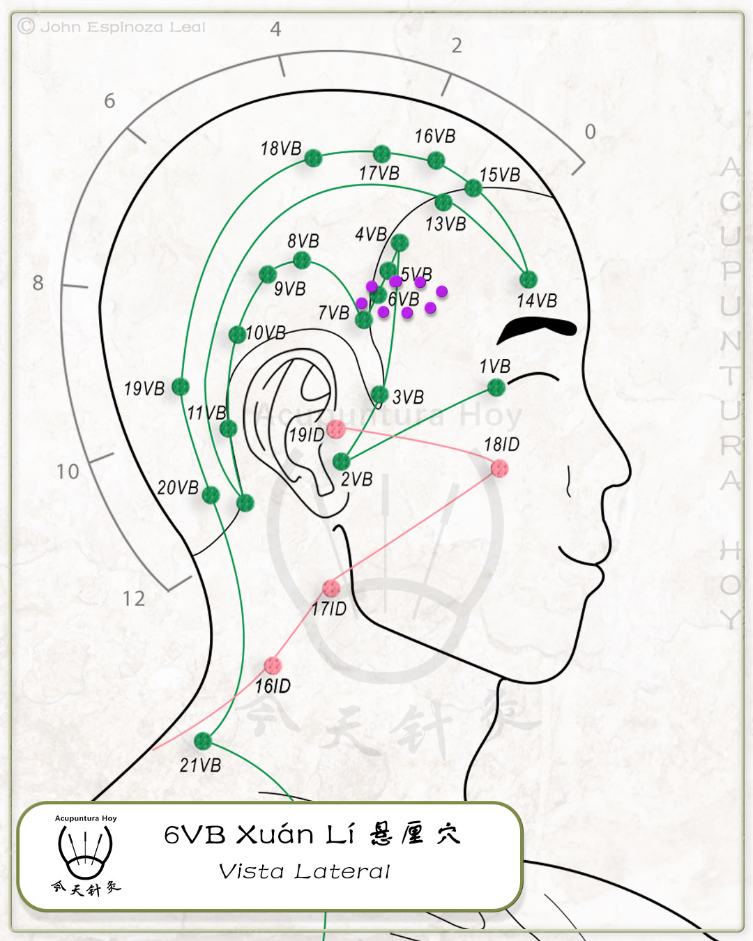 6VB Xuán Lí 悬厘穴