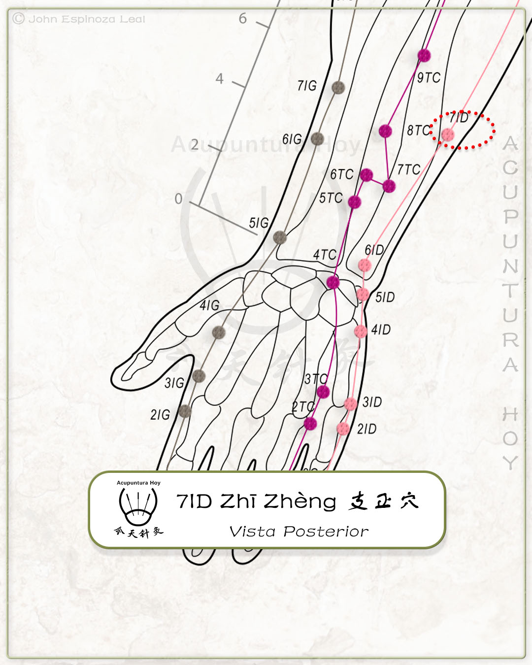 7ID Zhī Zhèng 支正穴