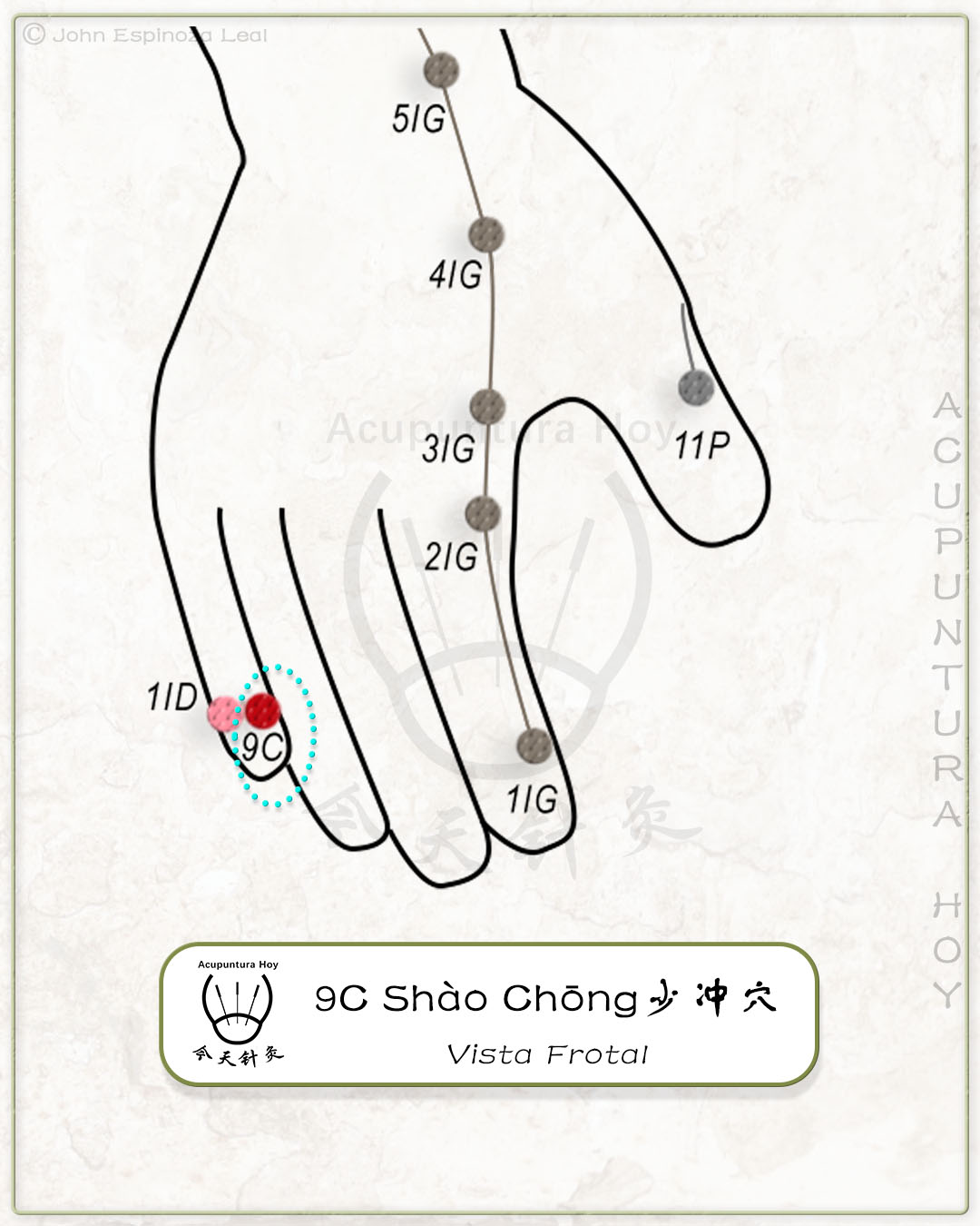 9C Shào Chōng 少冲穴