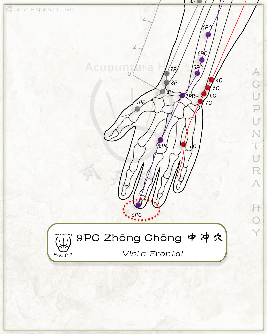 9PC Zhōng Chōng 中冲穴