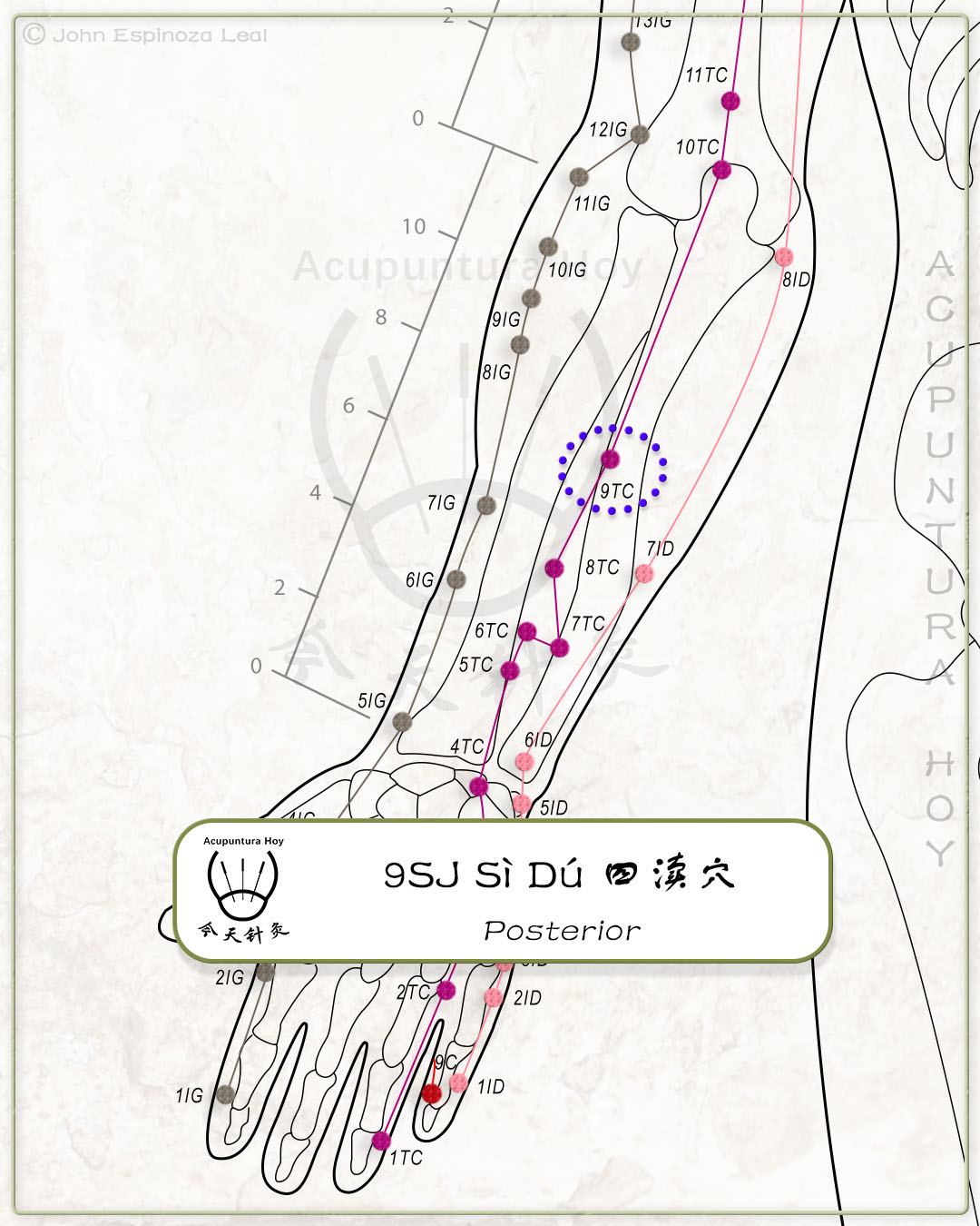 9SJ Sì Dú 四渎穴