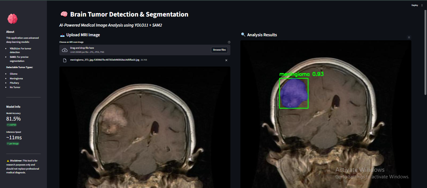 Brain Tumor Detector