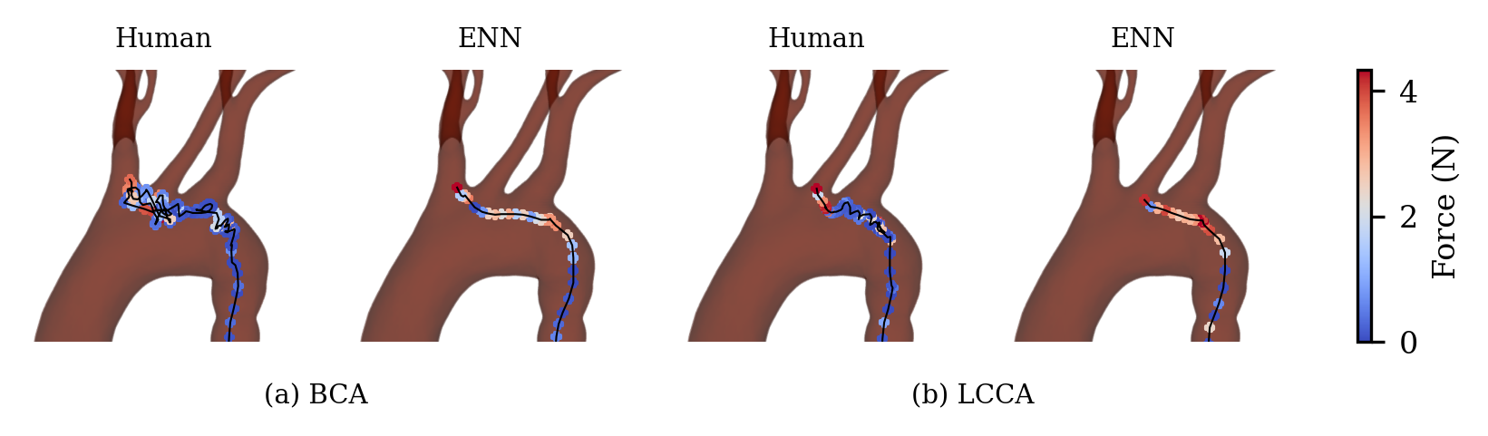 path comparison between human and ENN