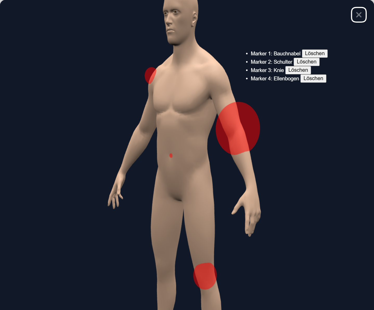 Marker list and markers placed on the 3D model