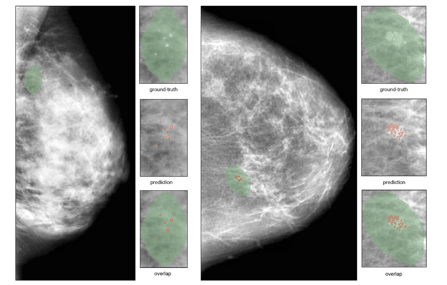 Segmentation Image