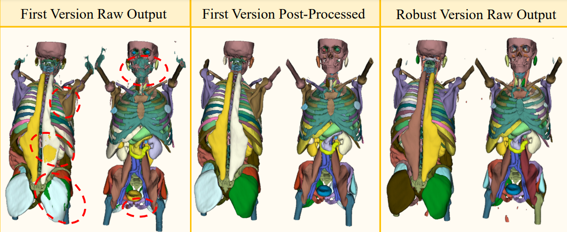 Model_comparison