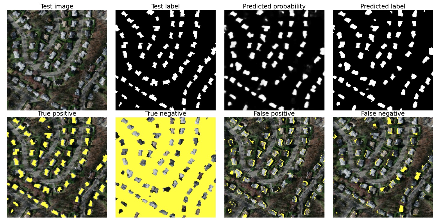 u-net deep learning model