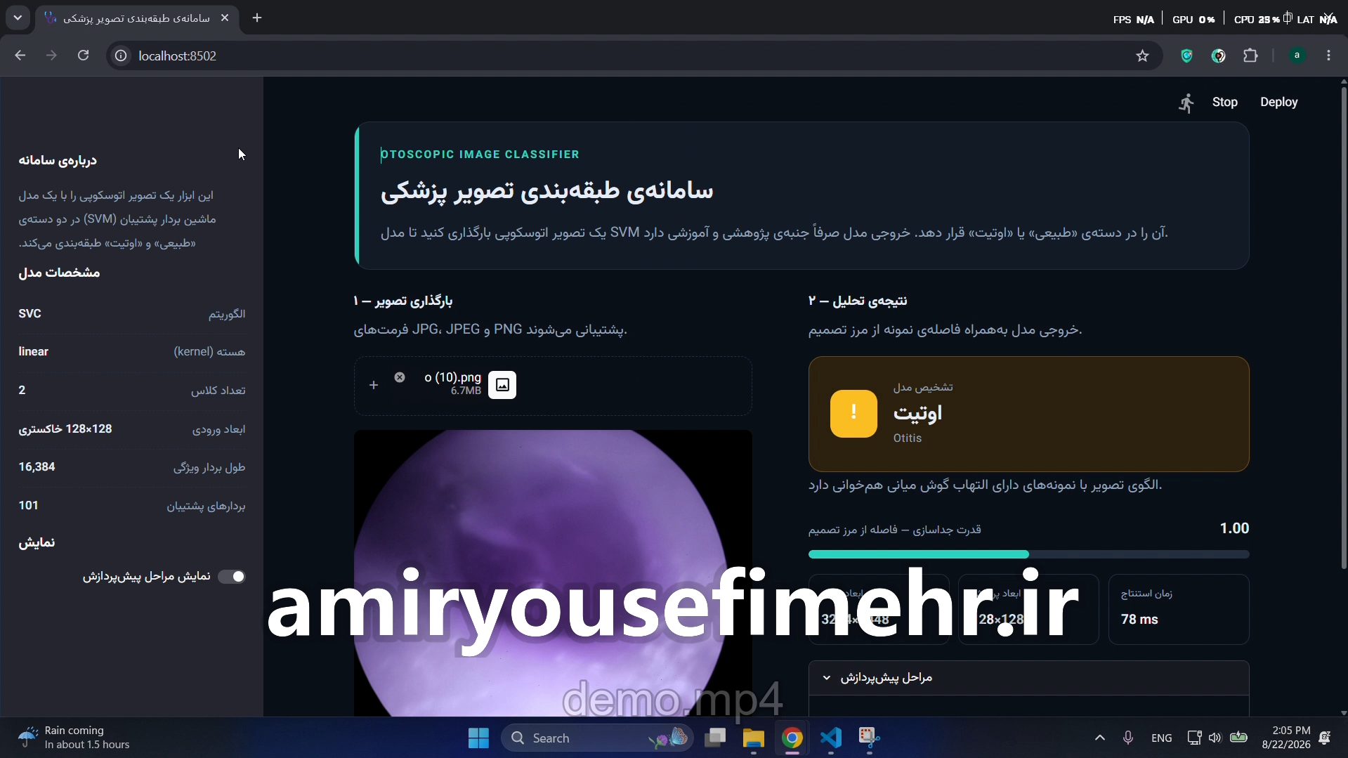 تصویر پروژهٔ تشخیص اوتیت با هوش مصنوعی