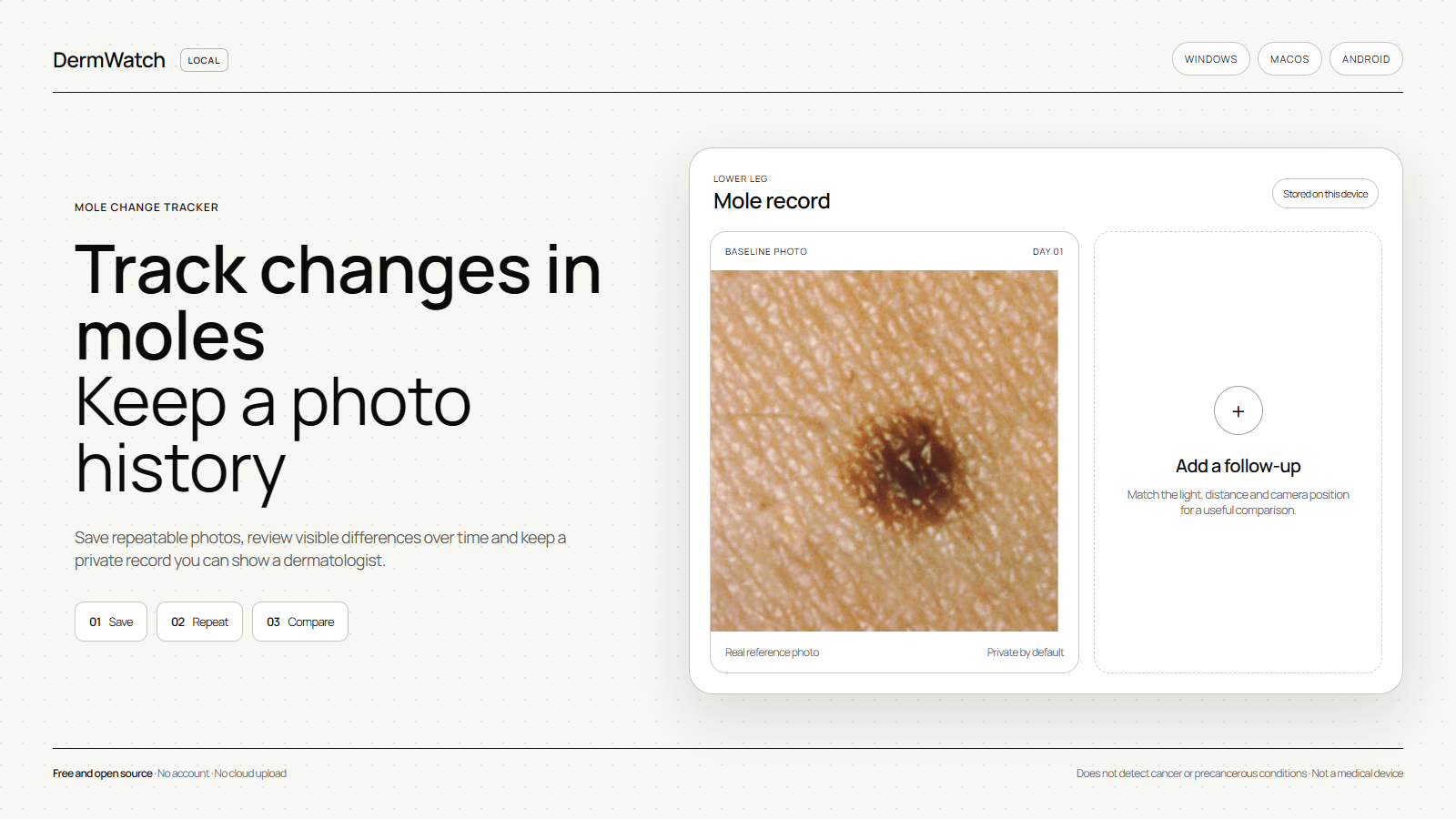 DermWatch preliminary visual warning-sign check and mole history