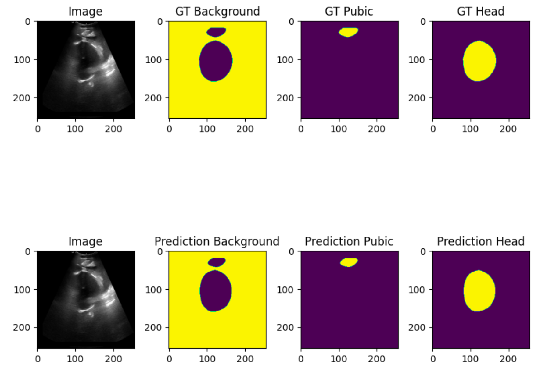 Segmentation result