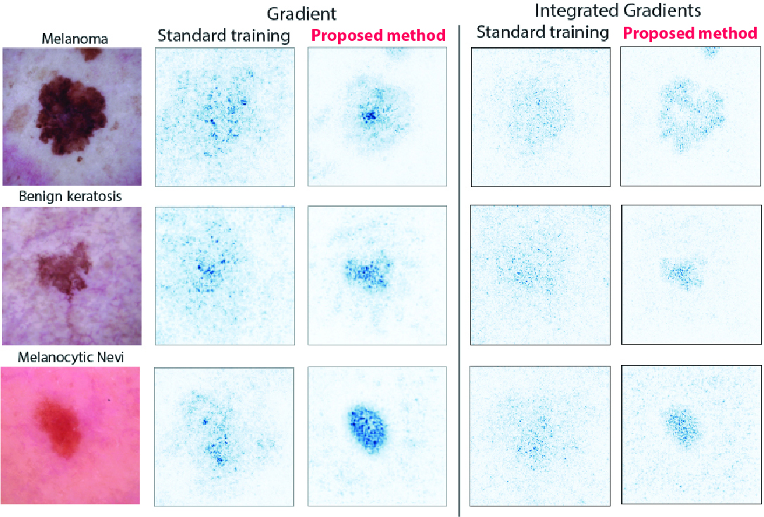 Interpretability results on Gradient and Integrated Gradience of Standard Training vs Adversarial Training (proposed method)