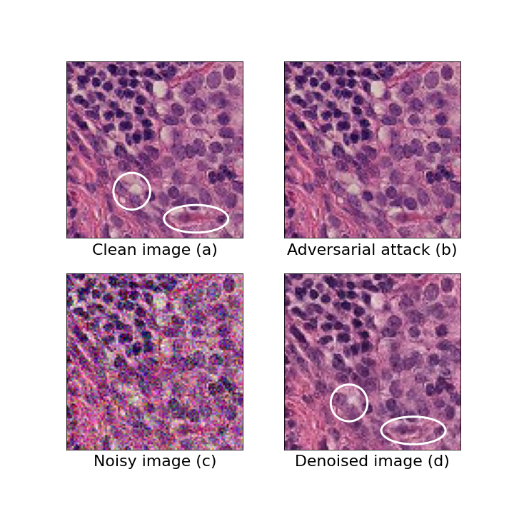 An example of a tissue sample in the different stages of the model pipeline