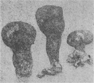 「第１図　ポリサックム菌二種」のキャプション付きの図