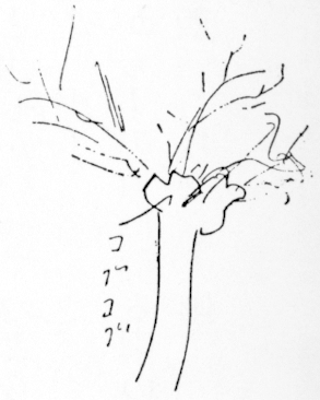 木の絵:太い幹、上部に「コブコブ」(幾つかの瘤)、瘤から細い枝が沢山出ている。