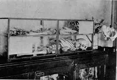 「第65図 1542-1543にヴェサリウスがバーゼルで作成した骨格」のキャプション付きの図