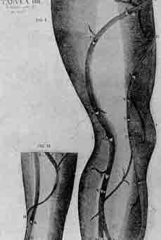 「第72図 静脈の弁を示しているファブリシウスの図(1603)」のキャプション付きの図