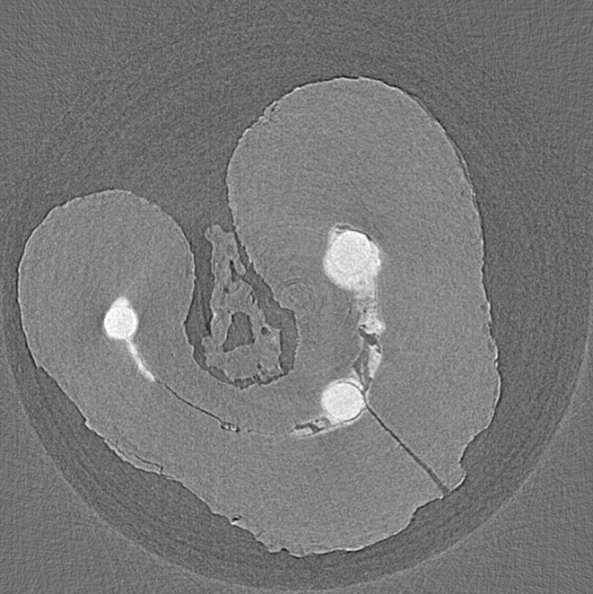 expected_medical_image