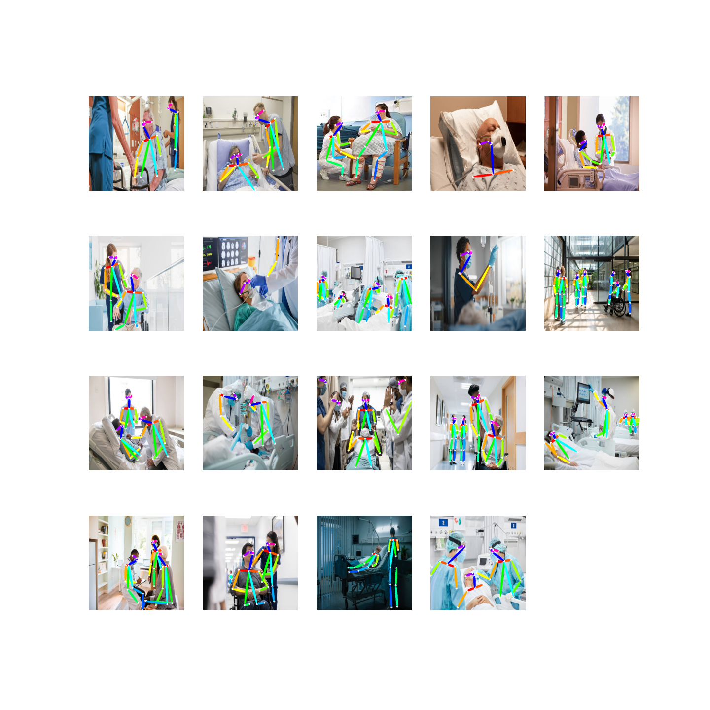 Skeletal keypoints overlaid on a person in a clinical pose-estimation result