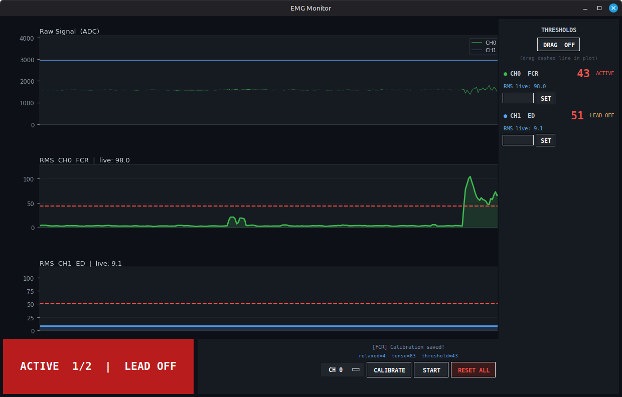 EMG Monitor GUI