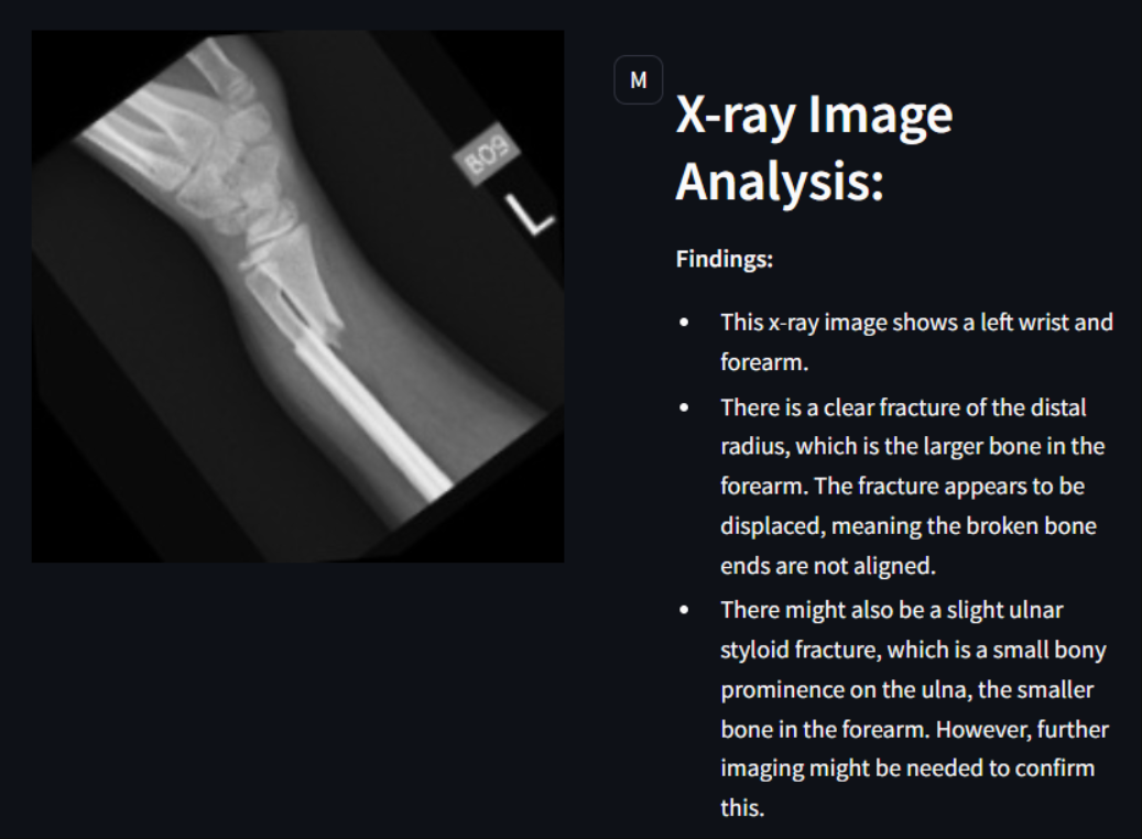 Axe Analytics Screenshot