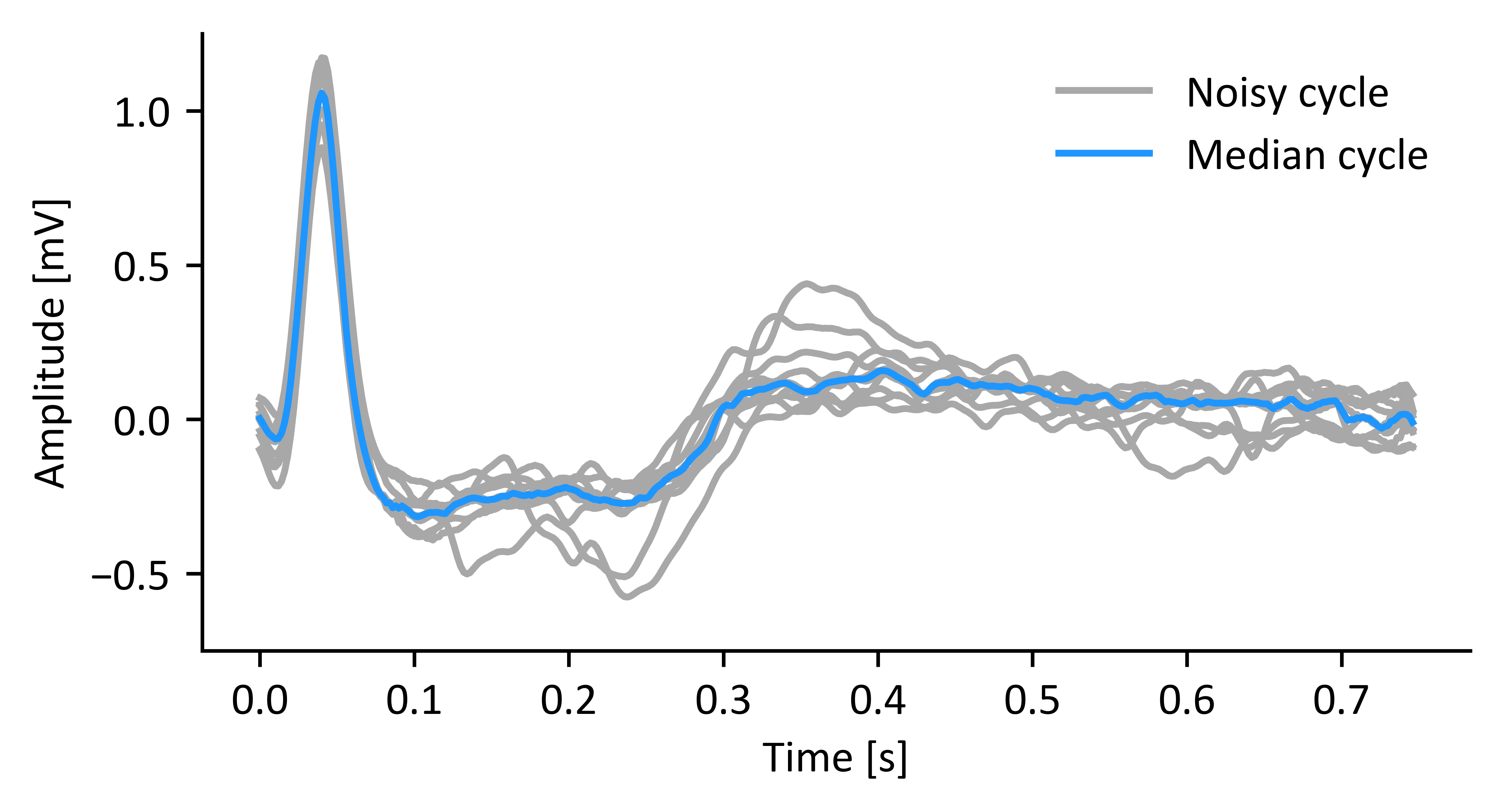 Median-based template of a cardiac cycle