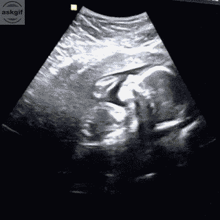 तनाव मुक्त दिनों की याद दिलाएं।