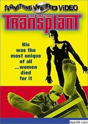 The Amazing Transplant