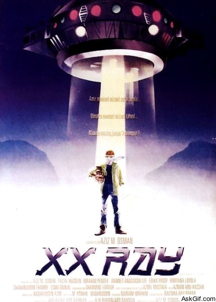 XX Ray