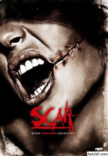 Scar