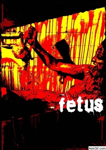 Fetus