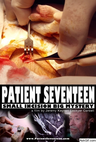 Patient Seventeen