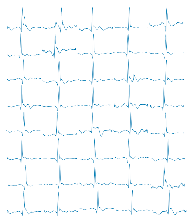 generated ecg