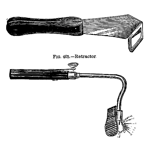 retractor