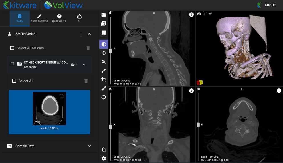 A screenshot of a sample VolView session