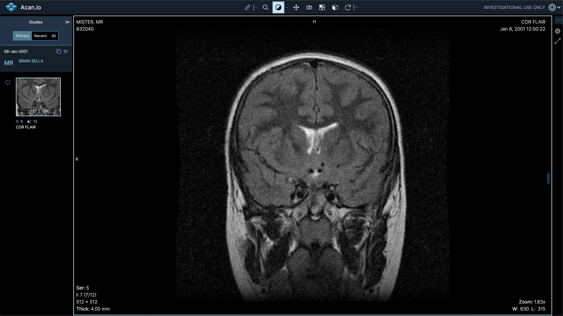 download the new version for android Lim DICOM Viewer