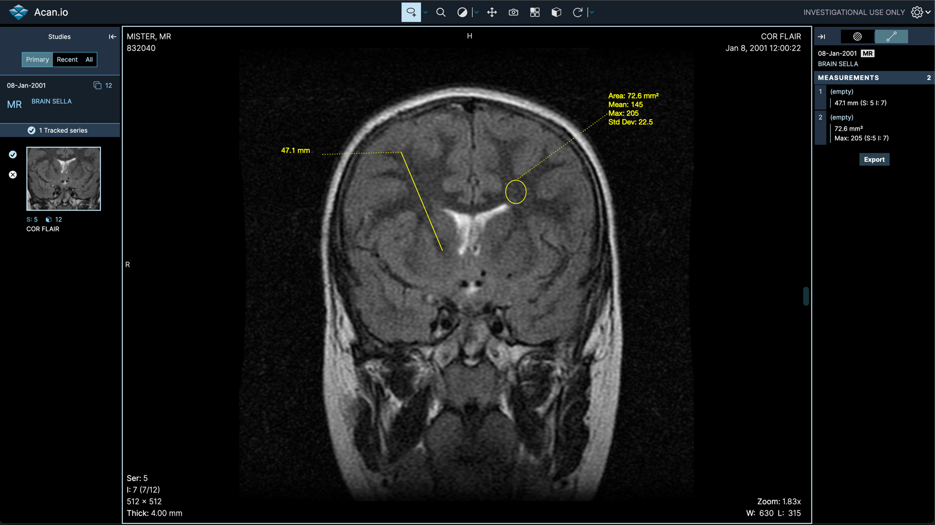 weasis dicom viewer free download