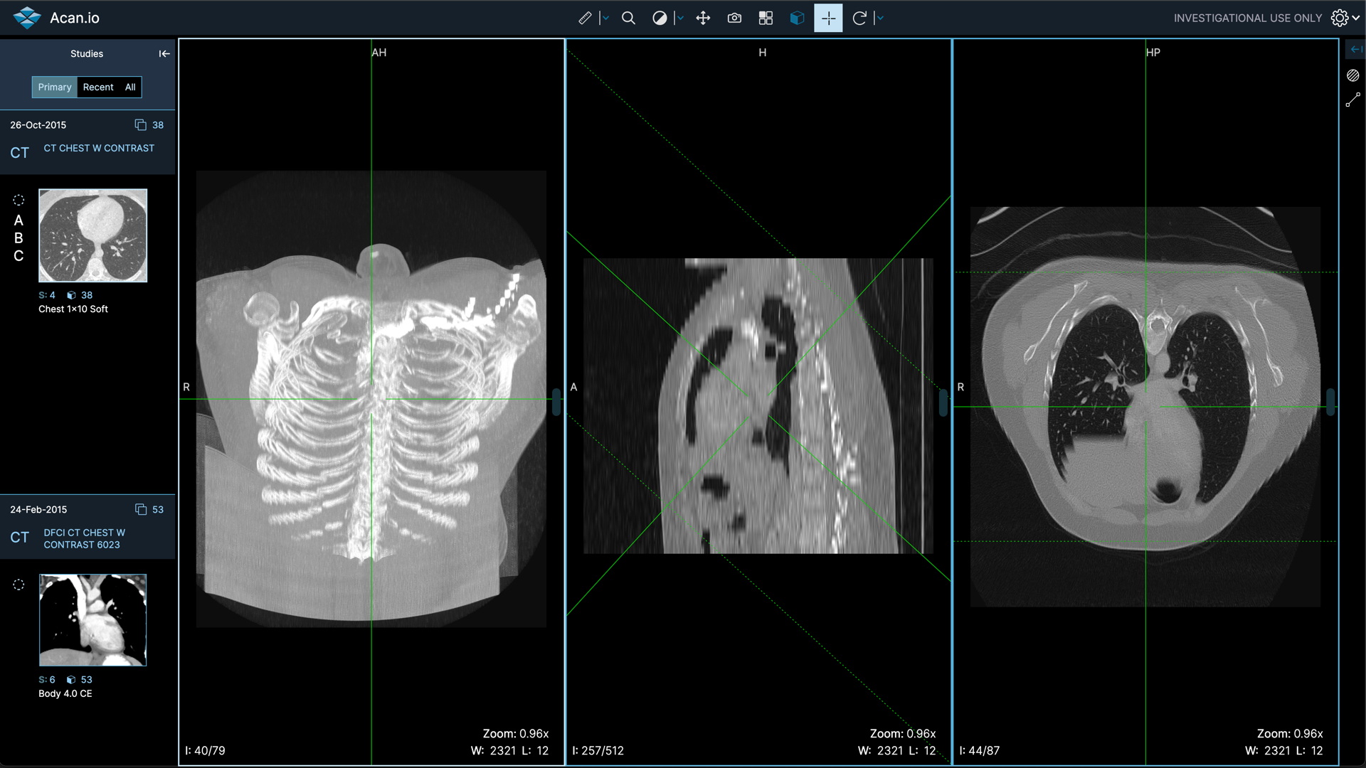 free dicom viewer onis