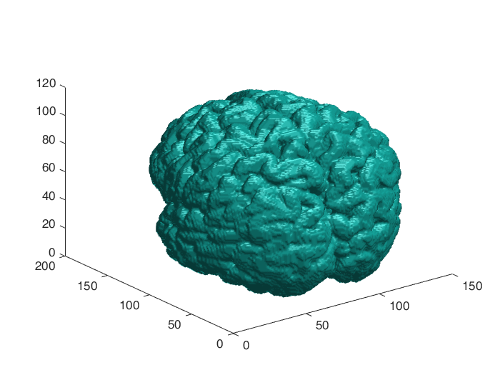 Matlab Brain Imaging GitHub - aznxed/brain-mri-segmentation: MATLAB file reads in a brain ...