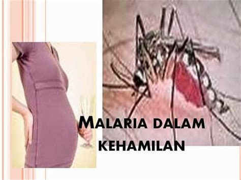 Malaria pada Wanita Hamil: Dampak dan Cara Mengatasinya