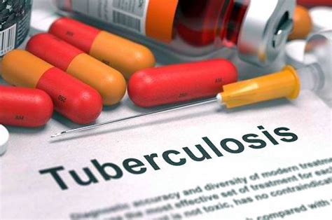 Pengobatan Tuberkulosis: Obat-obatan dan Perawatan yang Bisa Dilakukan untuk Mengatasi Penyakit Ini
